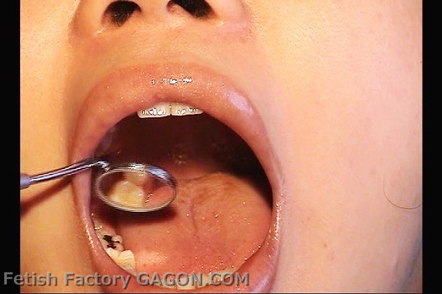 Mouth Scene013