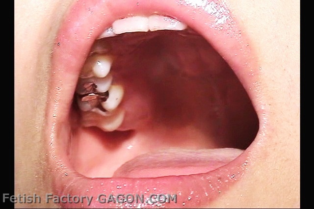 Mouth Scene018