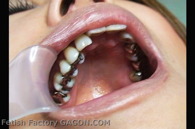 Mouth Scene032