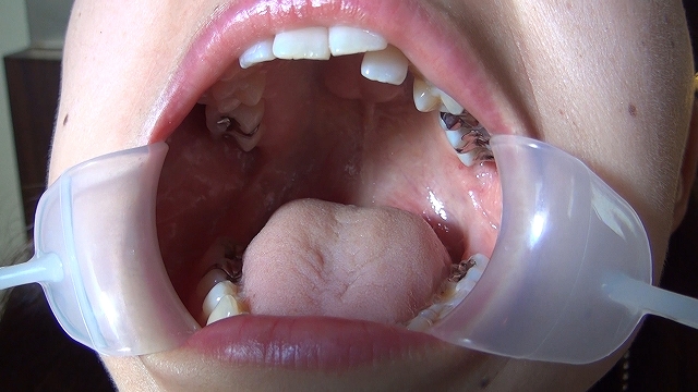 Mouth Scene047